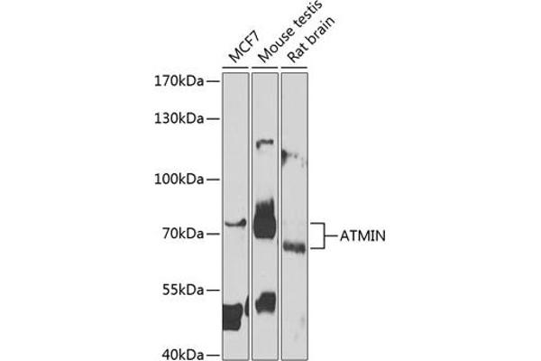 ATM Interactor antibody  (AA 160-360)