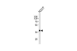 Western blot analysis of lysate from NCCIT cell line, using SOX2 Antibody (ABIN387798 and ABIN2843854). (SOX2 antibody)