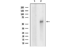 anti-Solute Carrier Family 16 (Monocarboxylic Acid Transporters), Member 6 (SLC16A6) antibody