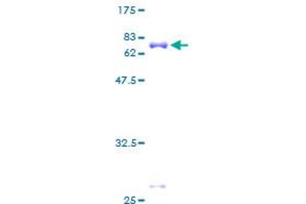 TARBP2 Protein (AA 1-366) (GST tag)