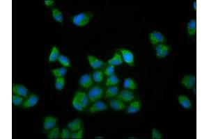 Immunofluorescence staining of Hela cells with ABIN7166026 at 1:133, counter-stained with DAPI. (RUFY3 antibody  (AA 243-352))