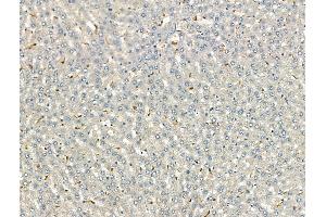 ABIN7093170 and ABIN7098475 at 1/100 staining Rat liver tissue by IHC-P. (C3 antibody  (Internal Region))