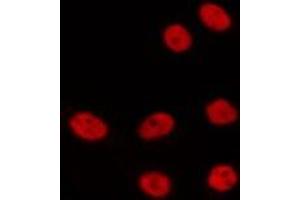 ABIN6275329 staining HepG2 by IF/ICC. (NOLC1 antibody  (C-Term))