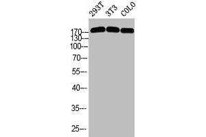 Western blot analysis of 293T 3T3 COLO using p-Topo IIα (S1525) antibody. (Topoisomerase II alpha antibody  (pSer1525))