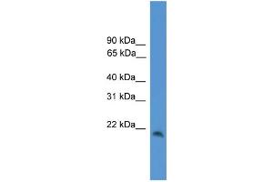 WB Suggested Anti-CBLN1 Antibody Titration: 0. (CBLN1 antibody  (C-Term))