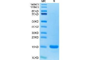 Human CCL7 on Tris-Bis PAGE under reduced condition. (CCL7 Protein (AA 24-99) (His tag))