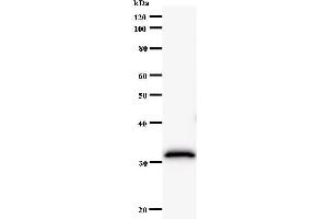 Western Blotting (WB) image for anti-F-Box and Leucine-Rich Repeat Protein 4 (FBXL4) antibody (ABIN931099) (FBXL4 antibody)