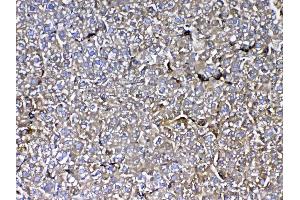 IHC analysis of MBL2 using anti-MBL2 antibody . (MBL2 antibody  (AA 19-244))