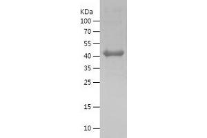 Western Blotting (WB) image for MutL Homolog 1 (MLH1) (AA 407-756) protein (His tag) (ABIN7283071) (MLH1 Protein (AA 407-756) (His tag))
