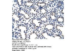 Rabbit Anti-POP4 Antibody  Paraffin Embedded Tissue: Human Lung Cellular Data: Alveolar cells Antibody Concentration: 4. (RPP29 antibody  (C-Term))