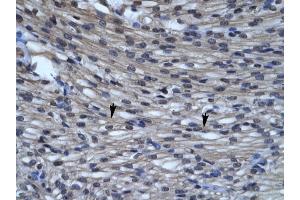 CLIC5 antibody was used for immunohistochemistry at a concentration of 4-8 ug/ml to stain Myocardial cells (arrows) in Human Heart. (CLIC5 antibody  (C-Term))