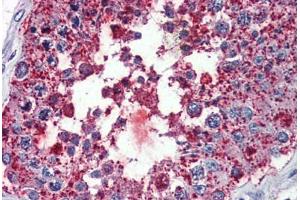Testis, Human: Formalin-Fixed, Paraffin-Embedded (FFPE) (Bestrophin 3 antibody  (Cytoplasmic Domain))