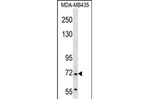 Western blot analysis in MDA-MB435 cell line lysates (35ug/lane). (GRHL2 antibody  (AA 409-438))