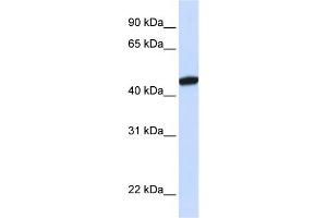 WB Suggested Anti-KRR1 Antibody Titration:  0. (KRR1 antibody  (C-Term))