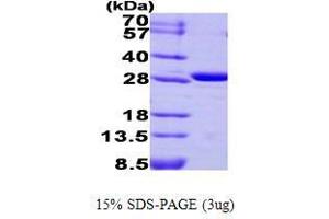 Figure annotation denotes ug of protein loaded and % gel used. (CA3 Protein (AA 1-260))