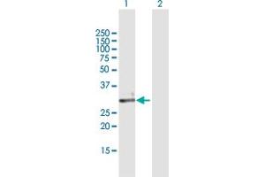 Western Blot analysis of ECH1 expression in transfected 293T cell line by ECH1 MaxPab polyclonal antibody. (ECH1 antibody  (AA 1-328))