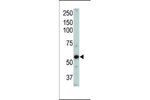 Western blot of ACVRL1 Pab (ABIN392241 and ABIN2841932). (ACVRL1 antibody  (N-Term))