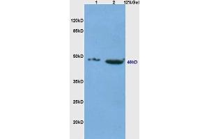 Lane 1: Mouse Thymus Lane 2: Mouse embryo probed with Anti-CD4 Polyclonal Antibody  at 1:5000 for 90 min at 37˚C. (CD4 antibody  (AA 301-400))