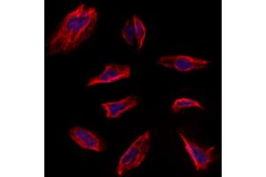 ABIN6263228 and ABIN6273139 staining Hela by IF/ICC. (MEST antibody  (C-Term))