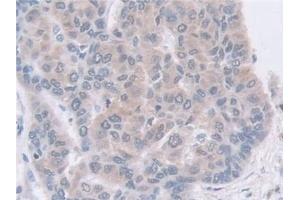 Immunohistochemistry (IHC) image for anti-Guanine Deaminase (GDA) (AA 1-454) antibody (ABIN7441532)
