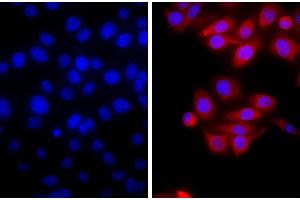Human pancreatic carcinoma cell line MIA PaCa-2 was stained with Mouse Anti-Cytokeratin 18-UNLB and DAPI. (Goat anti-Mouse IgG (Heavy & Light Chain) Antibody (Texas Red (TR)) - Preadsorbed)