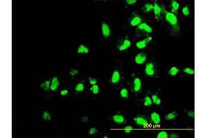 Immunofluorescence of monoclonal antibody to POLR1C on HeLa cell. (POLR1C antibody  (AA 1-346))