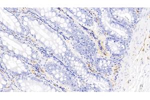 Detection of IL17 in Canine Colon Tissue using Polyclonal Antibody to Interleukin 17 (IL17) (IL-17 antibody  (AA 1-155))