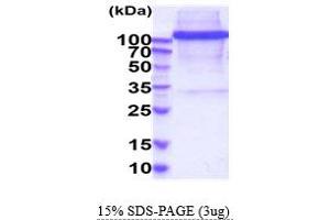 SDS-PAGE (SDS) image for CD163 (CD163) (AA 42-1050) protein (His tag) (ABIN6388130)