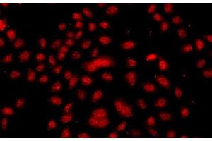 FBXW11 antibody