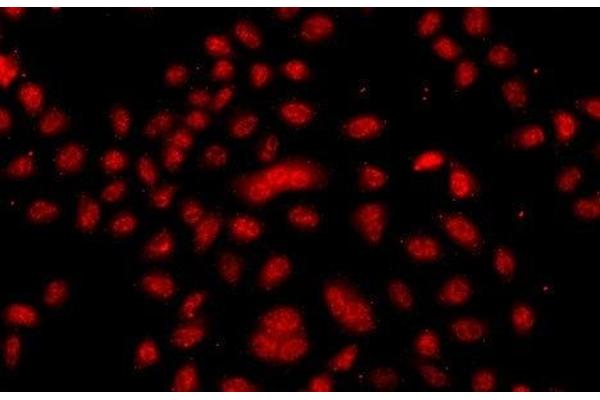 FBXW11 antibody