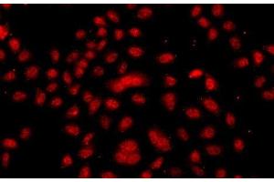 Immunofluorescence analysis of A549 cells using FBXW11 Polyclonal Antibody (FBXW11 antibody)