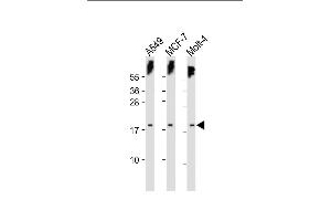 All lanes : Anti-KILLIN Antibody (C-term) at 1:500 dilution Lane 1: A549 whole cell lysate Lane 2: MCF-7 whole cell lysate Lane 3: Molt-4 whole cell lysate Lysates/proteins at 20 μg per lane. (KLLN antibody  (C-Term))