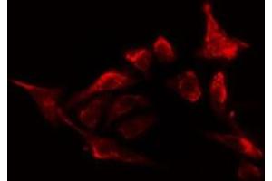 ABIN6278656 staining HepG2 cells by IF/ICC. (OXSR1 antibody  (pThr185))