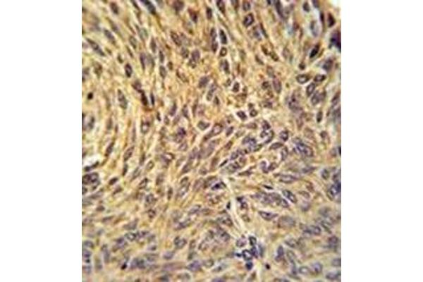 NUP210 antibody  (N-Term)
