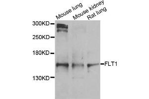 Western blot analysis of extracts of various cells, using FLT1 antibody.