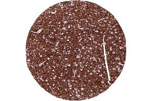 Cerebrum grey matter with intense L1CAM staining of nerve fibres