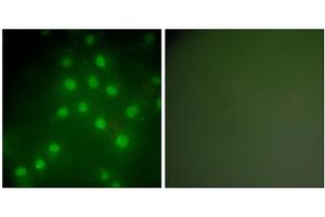 Immunofluorescence analysis of HepG2 cells, using HDAC9 antibody (ABIN5976425).
