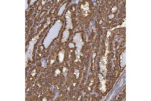 IHC analysis of SBP/SELENBP1 using anti-SBP/SELENBP1 antibody (ABIN7600755). (SELENBP1 antibody  (AA 23-462))