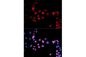 Immunofluorescent staining of U-2 OS cells with MAX (phospho S11) polyclonal antibody  at 1:50-1:200 dilution.
