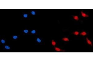 IF analysis of ADRM1/ARM-1 using anti-ADRM1/ARM-1 antibody (ABIN7600108).