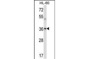 Western blot analysis in HL-60 cell line lysates (35ug/lane). (PRKACA/PRKACB antibody  (C-Term))