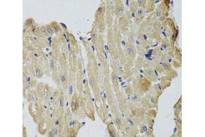 Immunohistochemistry of paraffin-embedded Rat heart using CKMT2 Polyclonal Antibody at dilution of 1:100 (40x lens). (CKMT2 antibody)