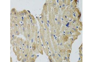 Immunohistochemistry of paraffin-embedded Rat heart using CKMT2 Polyclonal Antibody at dilution of 1:100 (40x lens).