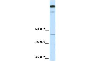 WB Suggested Anti-TIMELESS Antibody Titration:  0. (TIMELESS antibody  (N-Term))
