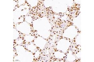 Immunohistochemistry of paraffin embedded mouse lung using WDR13 (ABIN7076212) at dilution of 1: 2500 (400x lens) (WDR13 antibody)