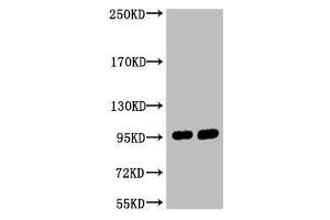 Western blot analysis of 1) Hela, 2) 293T, diluted at 1:2000. (ABCB5 antibody)