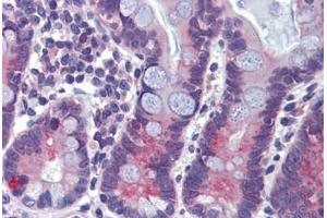 Immunohistochemistry (Paraffin-embedded Sections) (IHC (p)) image for anti-ATP-Binding Cassette, Sub-Family A (ABC1), Member 5 (ABCA5) (AA 1296-1345) antibody (ABIN6741601)