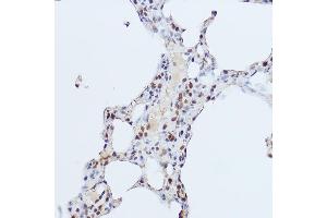 Immunohistochemistry (IHC) image for anti-Zinc Finger Protein GLI1 (GLI1) (AA 200-300) antibody (ABIN7271533)