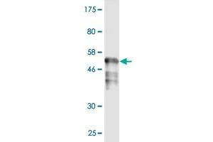 Western Blot detection against Immunogen (52. (RAD51 antibody  (AA 1-242))