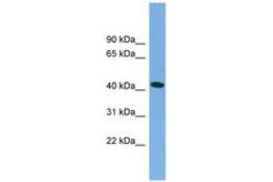 Image no. 1 for anti-Microtubule-Associated Protein tau (MAPT) (C-Term) antibody (ABIN6744848)
